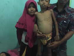 Yudhatul Hikmah Terserang Komplikasi Penyakit Gizi Buruk dan Suntikan Imunisasi Rubela