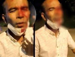 Begini Penjelasannya Terkait Video Viral Seorang Pria dengan Muka Berdarah di Pos Penyekatan