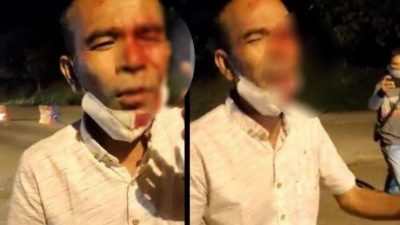 Begini Penjelasannya Terkait Video Viral Seorang Pria dengan Muka Berdarah di Pos Penyekatan